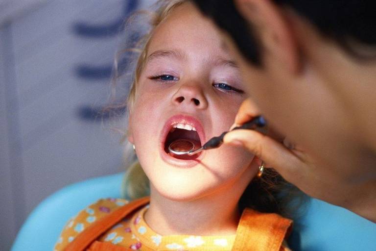 Ποια είναι άραγε η χειρότερη τροφή για τα δόντια των παιδιών;